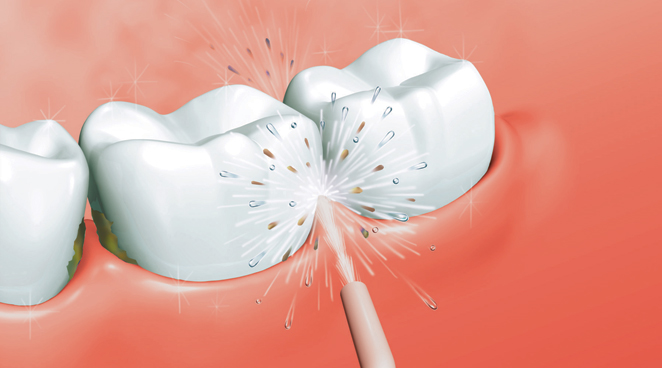 Уход за зубами: разоблачаем мифы